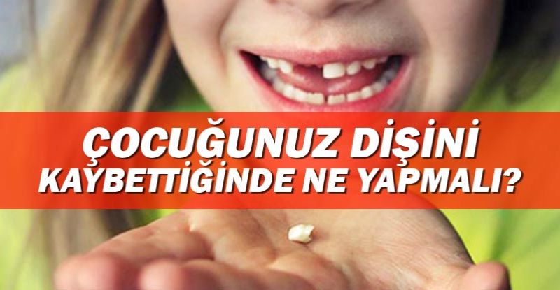 ÇOCUĞUNUZ DİŞİNİ KAYBETTİĞİNDE NE YAPMALI?